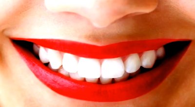 Отбеливание зубной эмали: вред или польза?