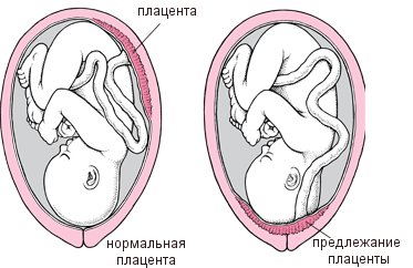 Нормальная плацента