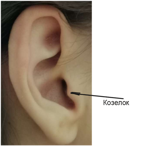 Анатомия ушных раковин | Пластический хирург Маркушин